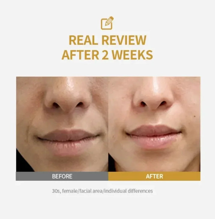 Kojic Acid & Niacinamide Whitening Serum