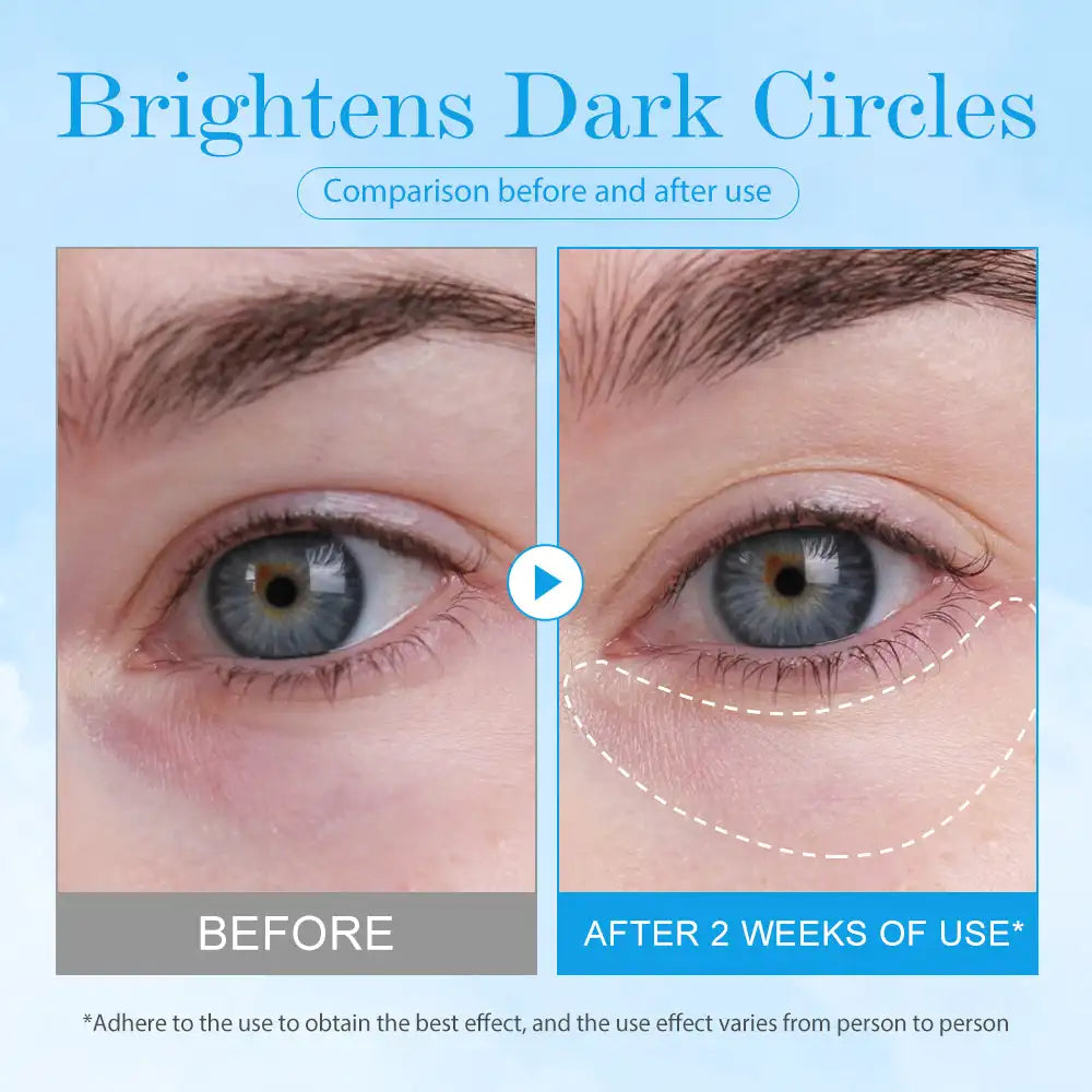 15ml Cooling Eye Gel