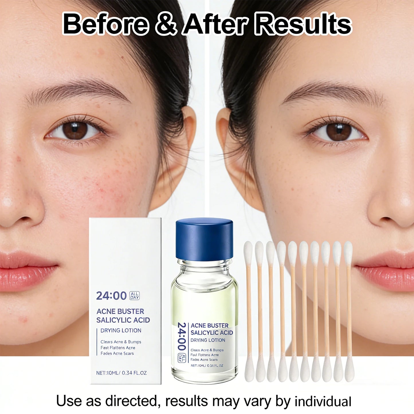 Salicylic Acid Face Serum with Cotton Swab